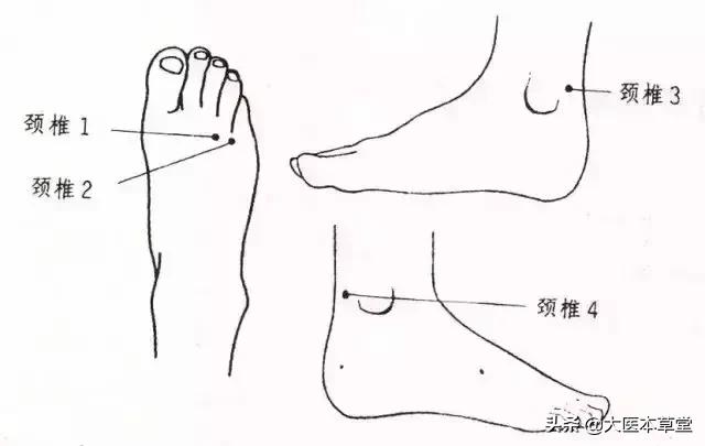 按摩脚颈治颈椎病.jpg